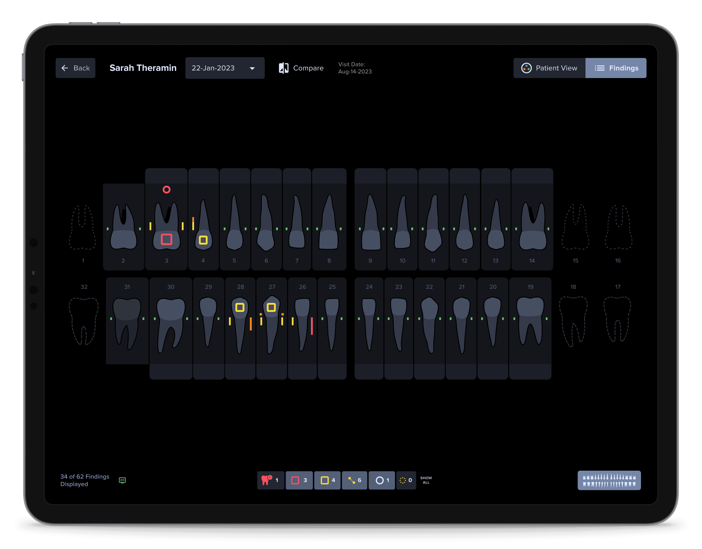 VideaHealth Odontogram